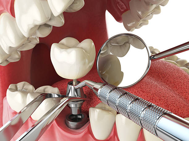 Reliable SC Emergency Dentist Solutions